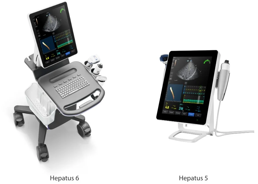 Hepatus Fibroscan